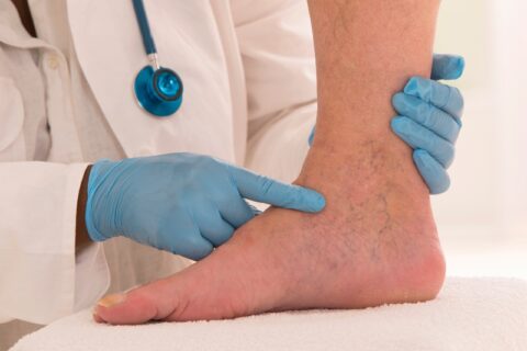 Lower limb vascular examination