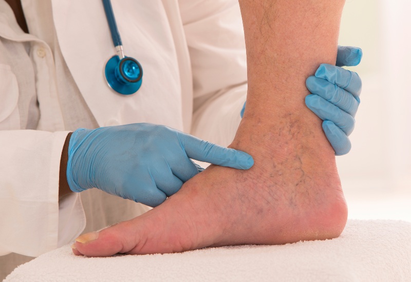 Lower limb vascular examination